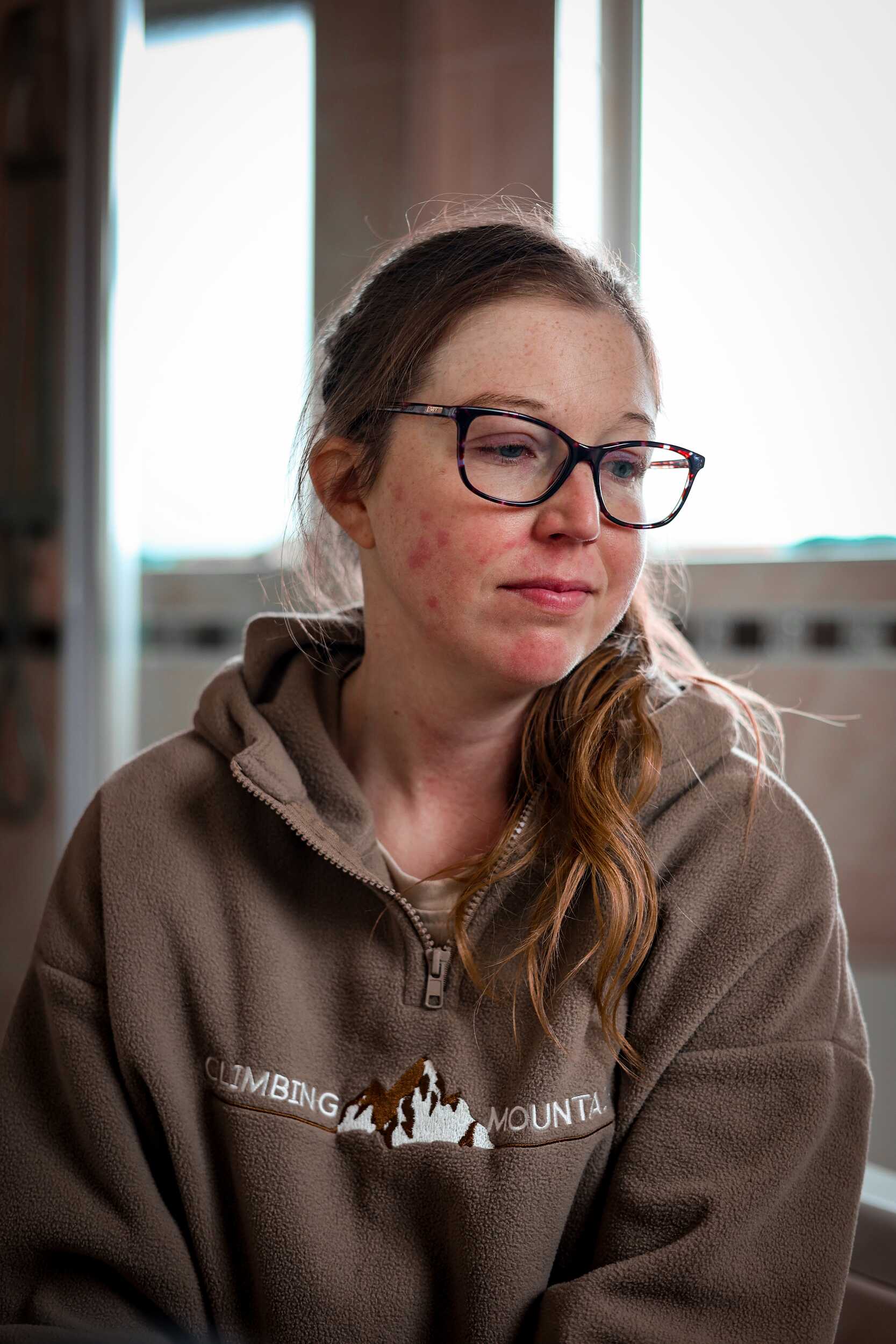 Lupus Rash