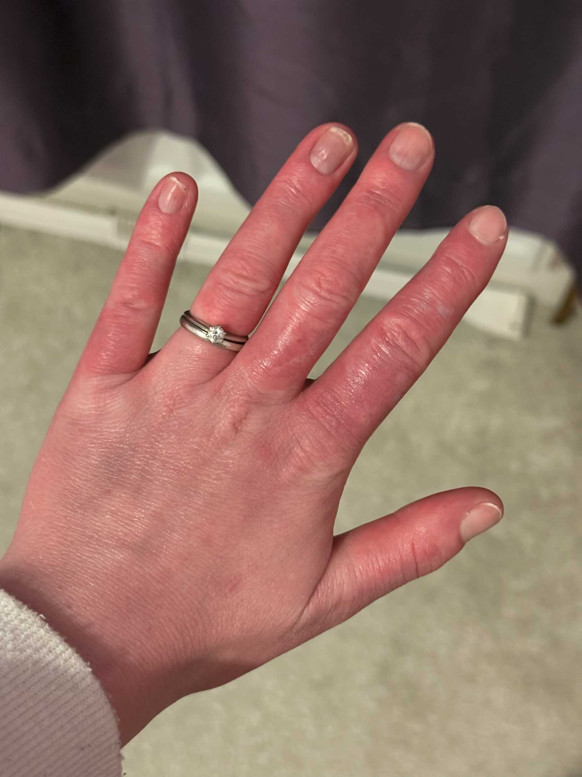 hand