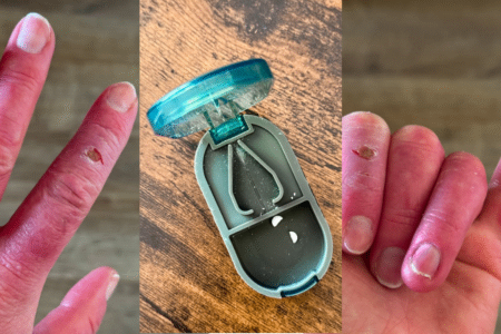 hand ulcers and tablets