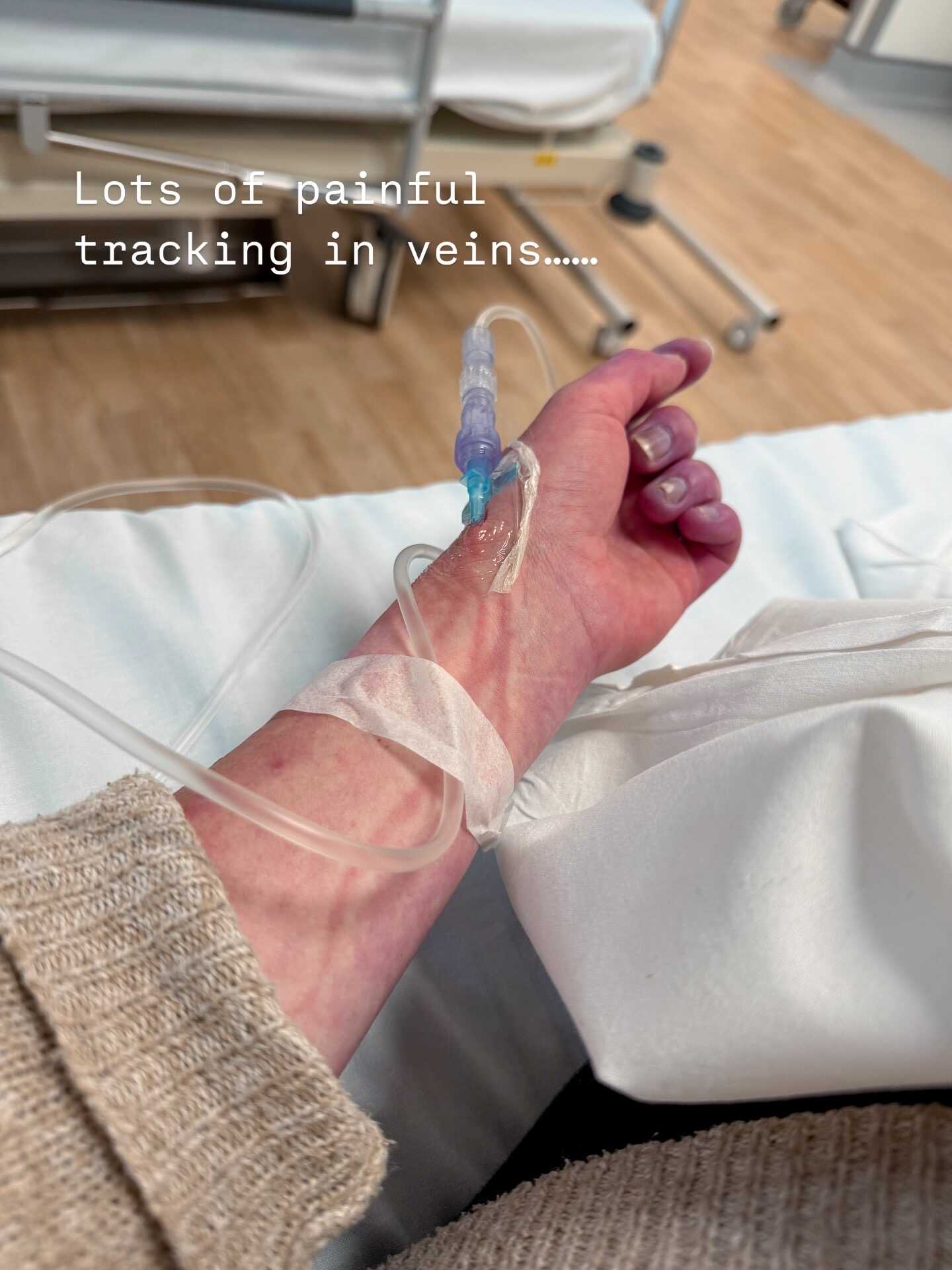 cannula